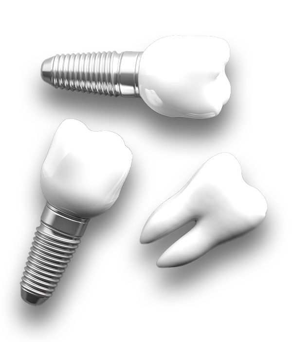 Zähne und Implantate